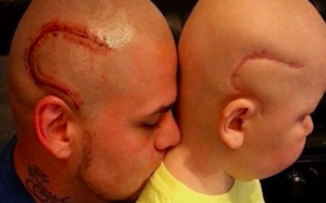 tatuaje de cicatriz de cancer