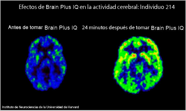 actividad cerebral con brain plus