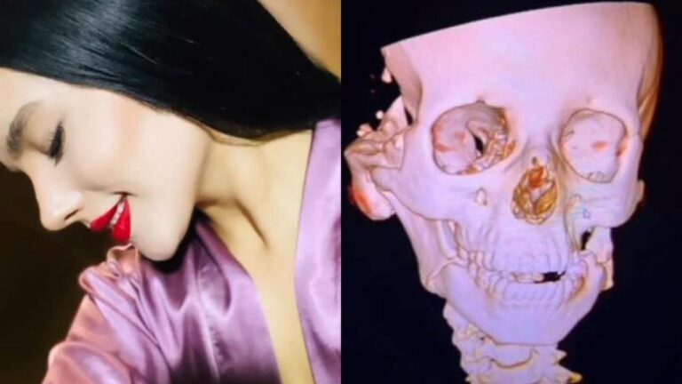 Piden justicia por Leonor; su novio la golpeó y la dejó en estado vegetativo